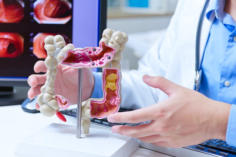 Surgeon using a model to explain Gastrointestinal Surgery to a patient.