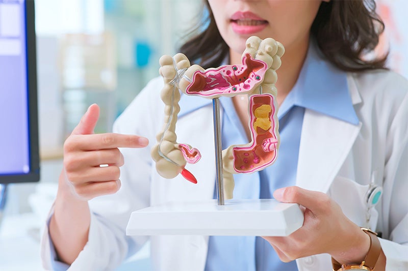 Surgeon showing anatomical model of colon to a patient to explain upcoming colon surgery.