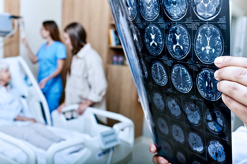 Physician looking at brain scan results.