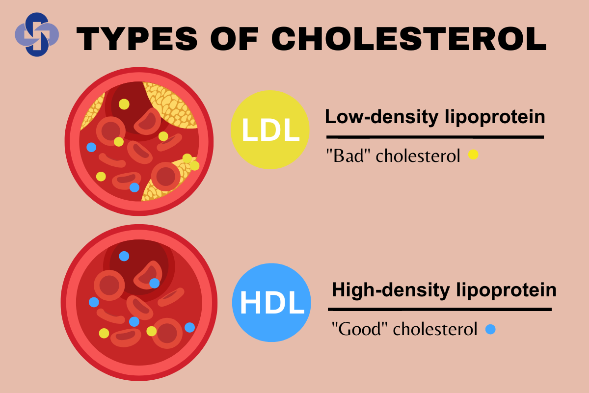 Cholesterol The Good And The Bad St Mary s Health Care System