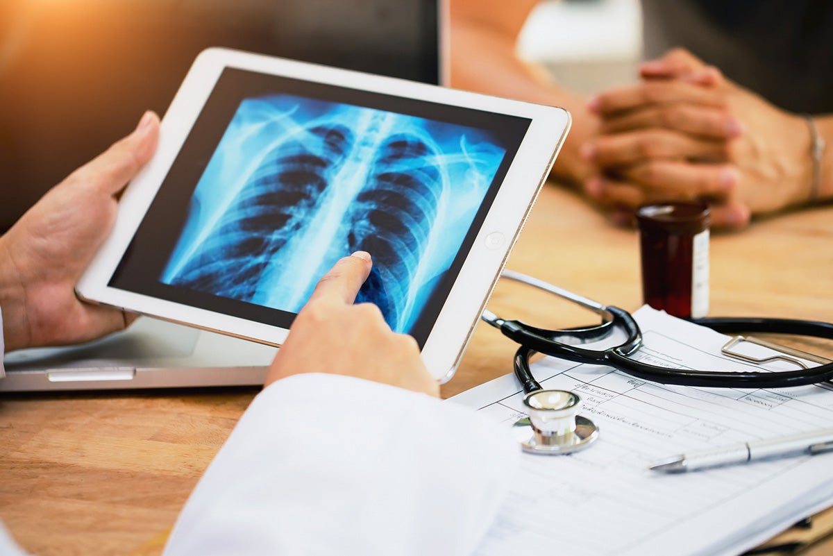 Lung Cancer: Prevention & Early Detection Saves Lives